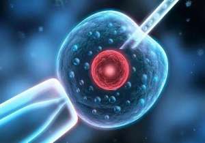 想到俄羅斯做第三代的試管嬰兒要多少的費用