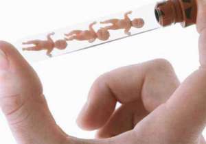 美國的試管嬰兒費用怎么算