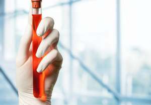 俄羅斯醫院做三代試管嬰兒的費用包含什么