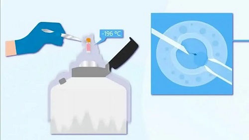 美國第三代試管嬰兒適合誰