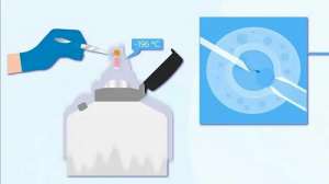 美國第三代試管嬰兒適合誰