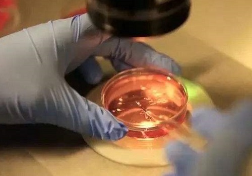 如何有效提高試管嬰兒的成功率