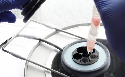 俄羅斯試管嬰兒費用介紹