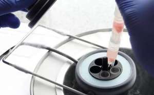 俄羅斯試管嬰兒費用介紹